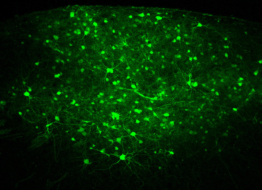 Sex hormones affect brain differentiation