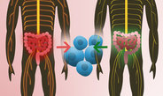 Zwillingsstudie: Natürliche Darmflora kann Multiple Sklerose auslösen
