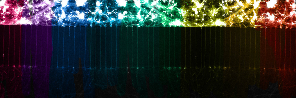 Neurons grown in microfluidic chambers can be used to treat axons and cell bodies separately