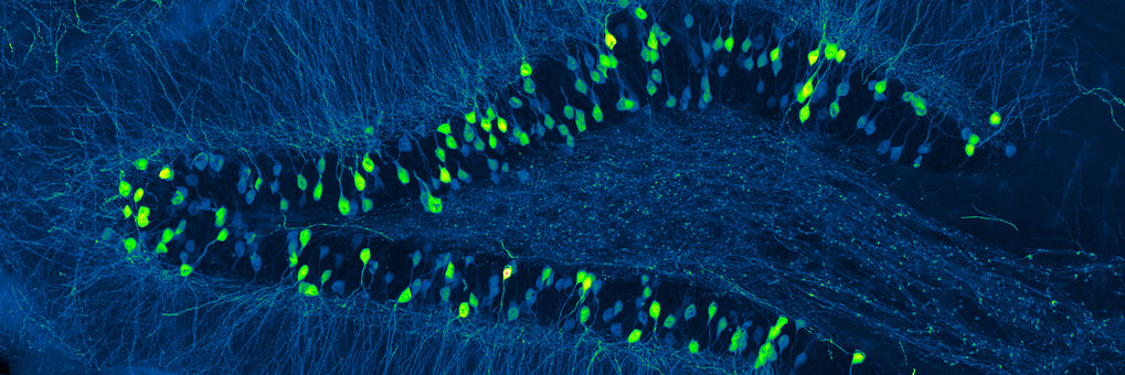 Fluoreszenzmikroskopiebilb, auf dem einzelne Zellen als hellgrüne Punkte und blaue Linien sichtbar sind.